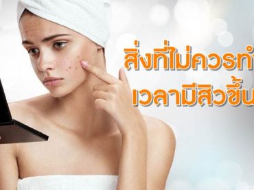 สิ่งที่ไม่ควรทำเวลามีสิวขึ้น