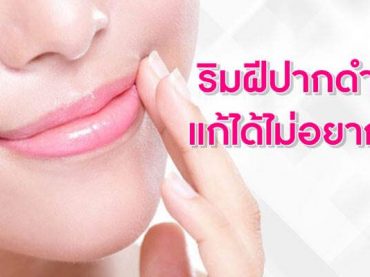 ริมฝีปากดำ-แก้ได้ไม่อยาก