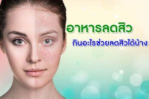 อาหารลดสิว-กินอะไรช่วยลดสิวได้บ้าง