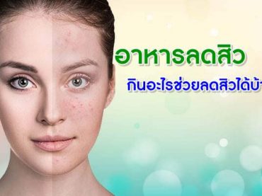 อาหารลดสิว-กินอะไรช่วยลดสิวได้บ้าง