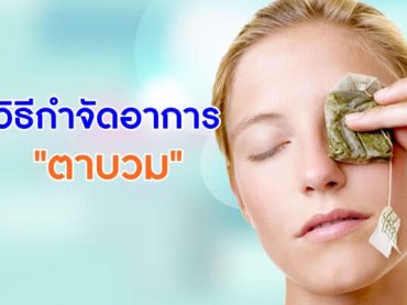 วิธีกำจัดอาการ-ตาบวม