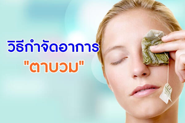 วิธีกำจัดอาการ-ตาบวม